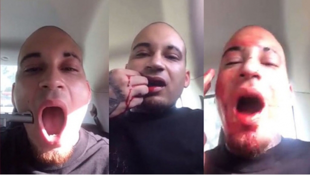 1635_se-dispara-en-la-mejilla_620x350